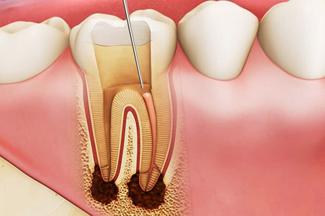- Top 5 Phòng Khám Điều Trị Tủy Răng Ở TPHCM An Toàn - Top 5 Phòng Khám Điều Trị Tủy Răng Ở TPHCM An Toàn