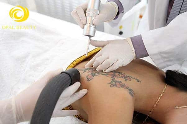 - Top 3 Địa Chỉ Xóa Xăm Không Sẹo Uy Tín Nhất Quận Bình Thạnh - Top 3 Địa Chỉ Xóa Xăm Không Sẹo Uy Tín Nhất Quận Bình Thạnh