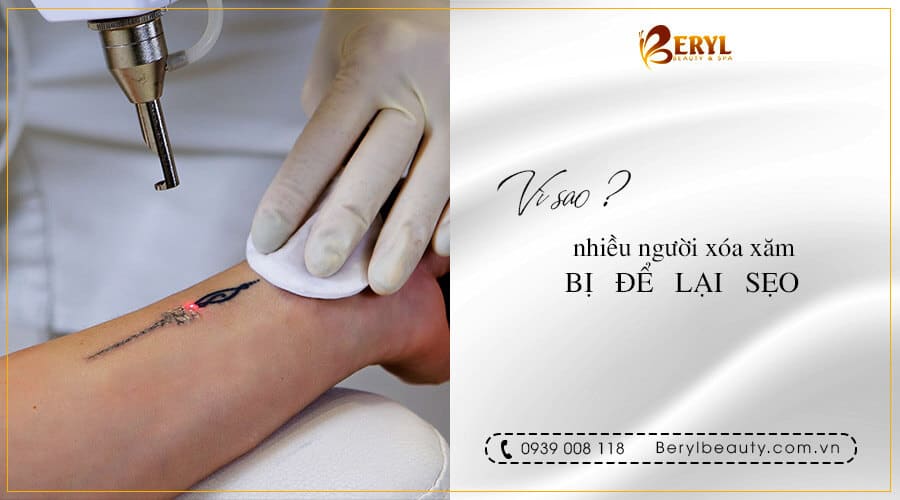 - Top 3 Địa Chỉ Xóa Xăm Không Sẹo Bình Thạnh Uy Tín - Top 3 Địa Chỉ Xóa Xăm Không Sẹo Bình Thạnh Uy Tín