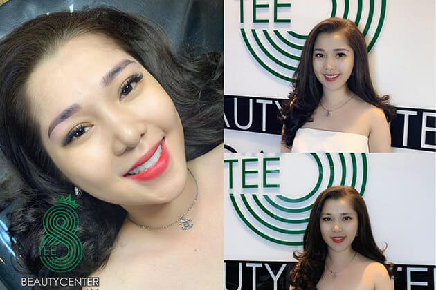 - Top 4 Địa Chỉ Xóa Xăm Chân Mày Phú Nhuận Uy Tín, Đẹp