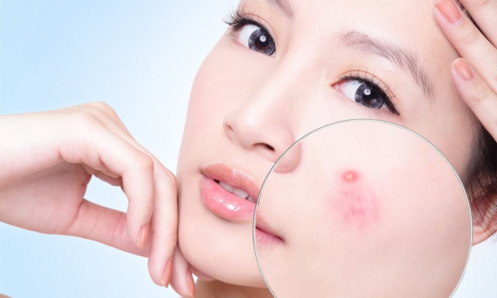 - Top 6 Viện Thẩm Mỹ Trị Mụn Uy Tín Tại Phú Nhuận