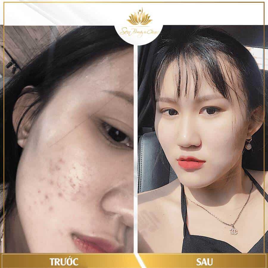 - Top 4 Thẩm Mỹ Viện Điều Trị Sẹo Chất Lượng Nhất Quận Phú Nhuận