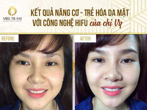 - Top 4 Thẩm Mỹ Viện Trẻ Hóa Da Hiệu Quả Nhất Quận Bình Thạnh