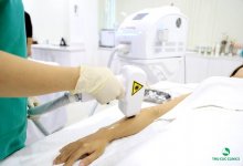 - Top 7 Thẩm Mỹ Viện Tẩy Lông An Toàn, Triệt Để Nhất TP HCM