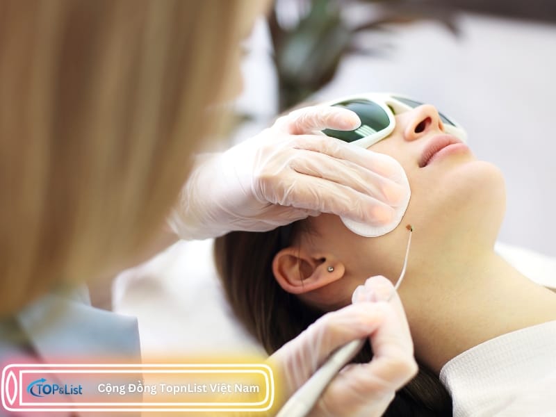 Địa Chỉ Tẩy Nốt Ruồi Uy Tín Nhất Quận 1 Sài Gòn - HCM